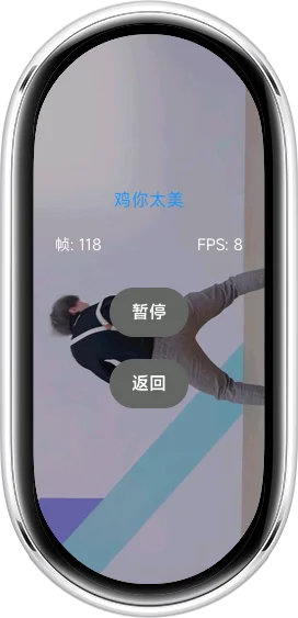 xiaomi_band_10-2026-02-15-18-58-54.webp